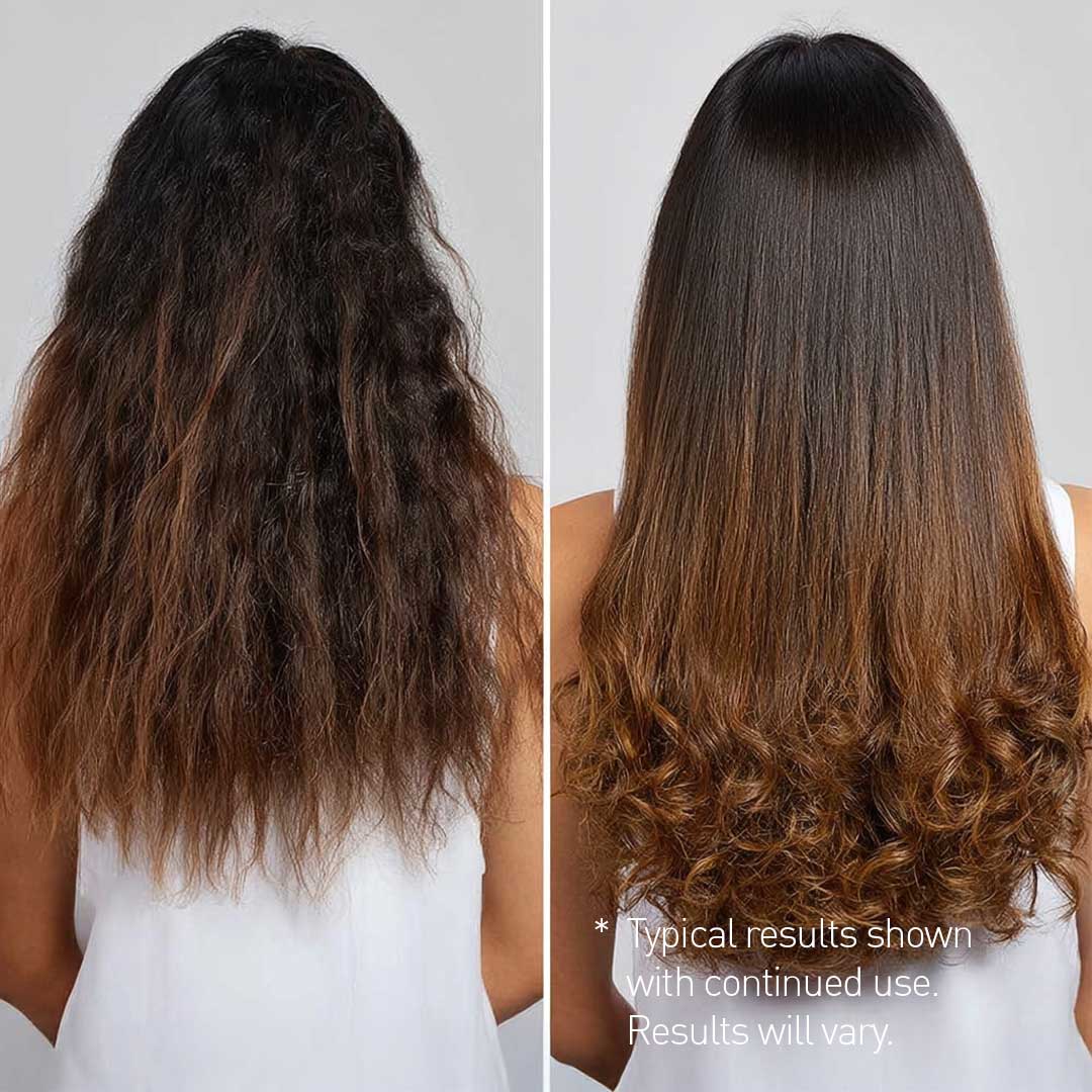 Onion & Rosemary Hair Growth Duo