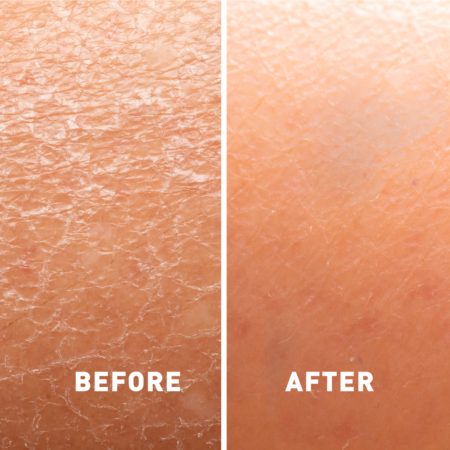 Before and after comparison of skin texture with 'Before' on left and 'After' on right.