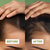 Before and after comparison of hair growth on a person's head with 'Before' and 'After' labels.
