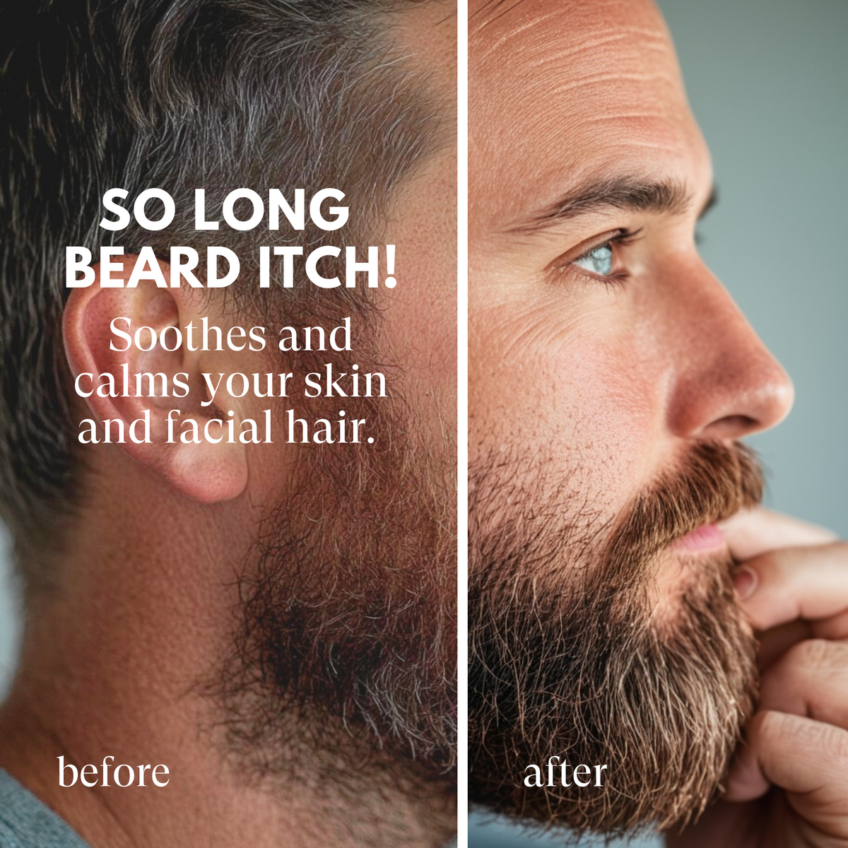 Before and after comparison of a man with beard itch, showing a soothed and calmed facial hair.