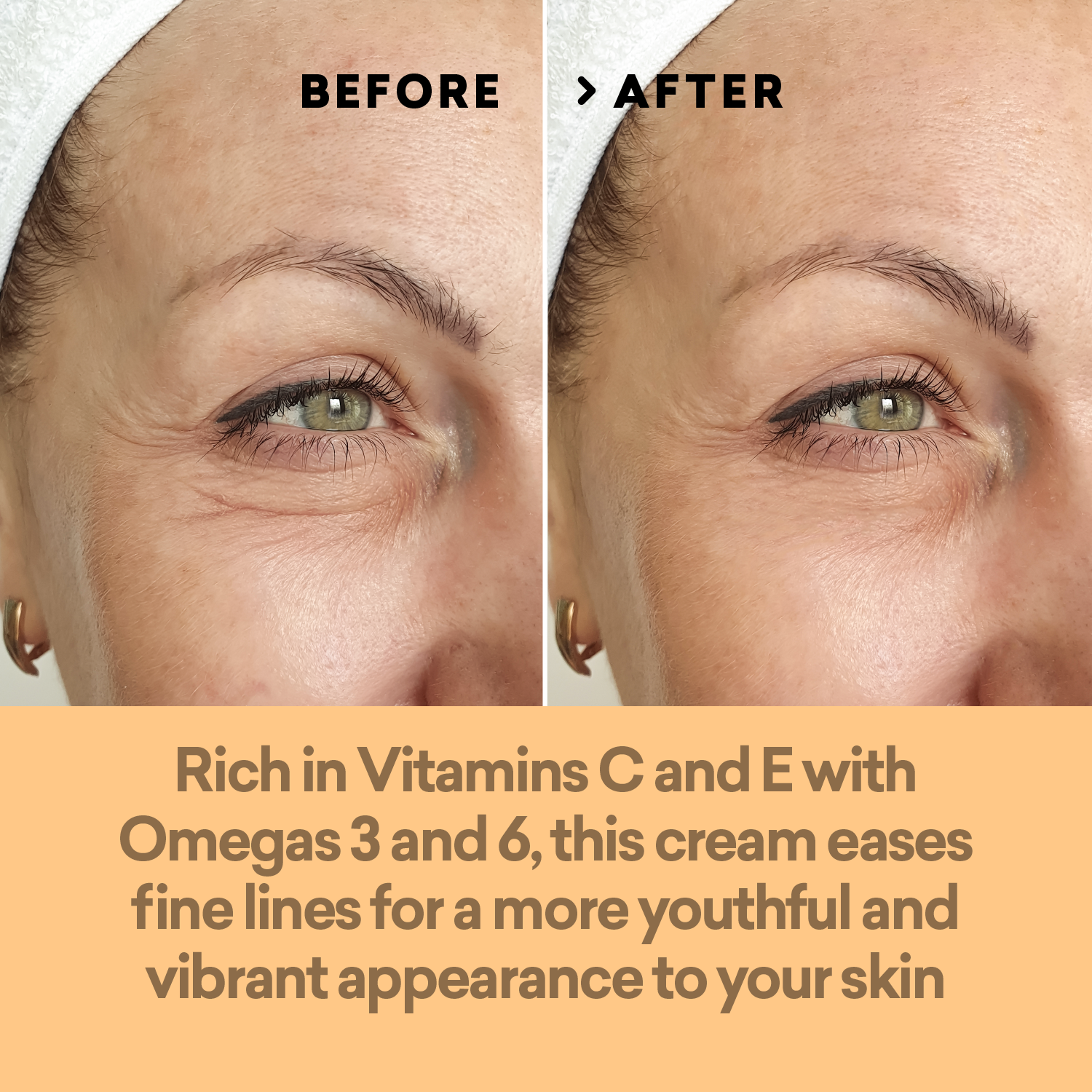 Before and after comparison of a person's eye area with text about a skin cream.