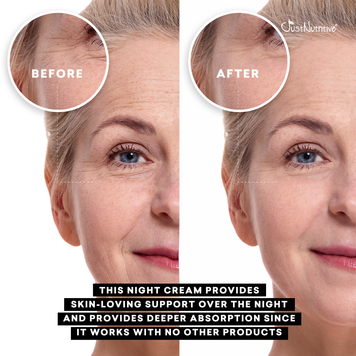 Before and after comparison of a woman's face with night cream application, showing smoother skin.