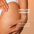 Close-up of skin with text highlighting a skincare product's effects on spots, scars, and stretch marks.